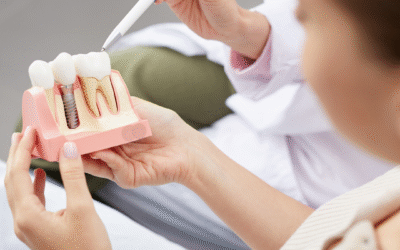 Exploring the Advantages of Dental Implants for Long-lasting Smiles