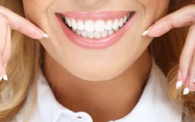 Smile Makeovers: Is It Time for a Transformation?